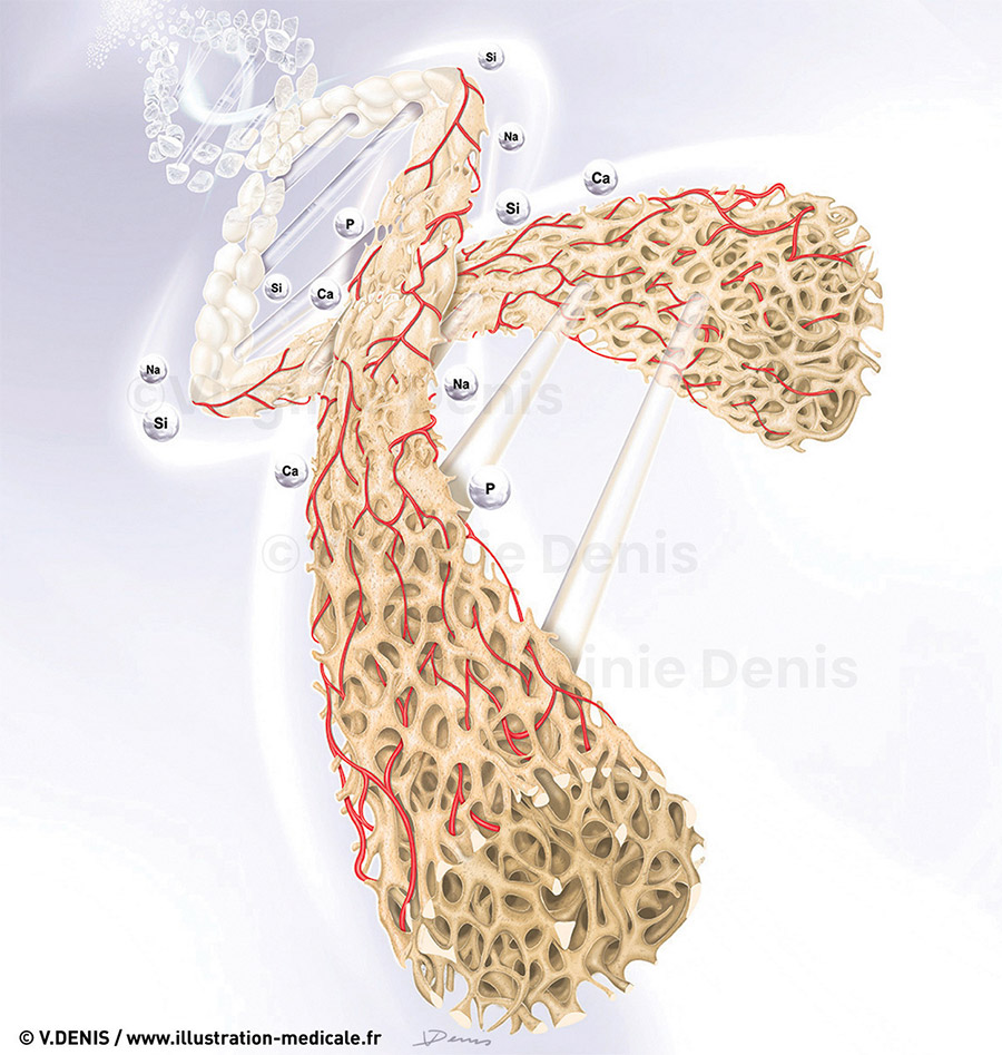 Illustration médicale Régénération osseuse artificielle - Stimulation osseuse