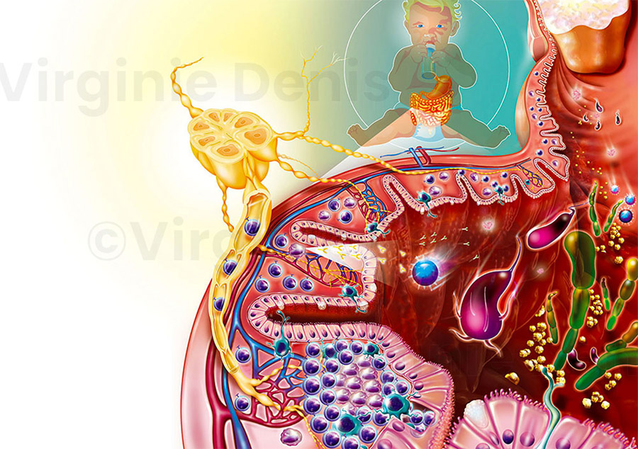 illustration médicale allergies alimentaires