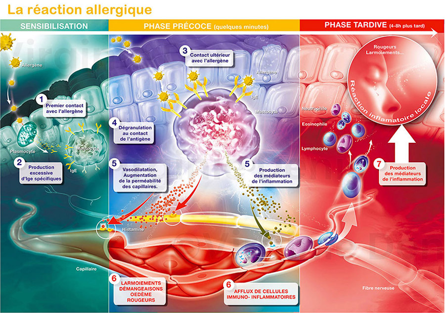 Illustration médicale réaction allergique