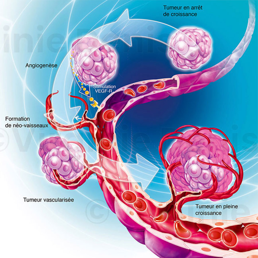 Illustration médicale angiogenèse