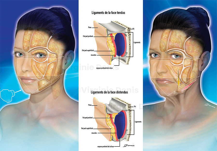 illustration médicale chirurgie esthétique