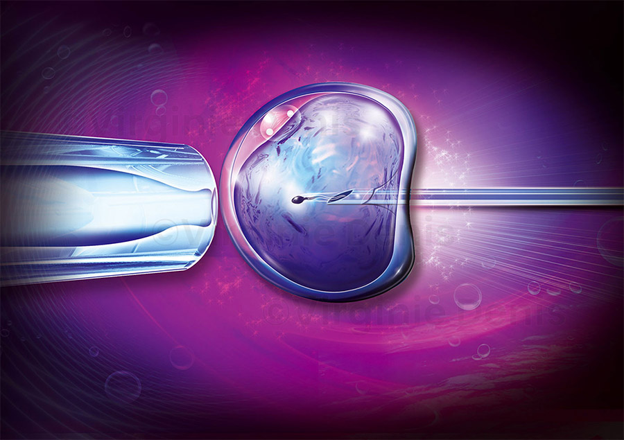 illustration médicale fécondation in vitro