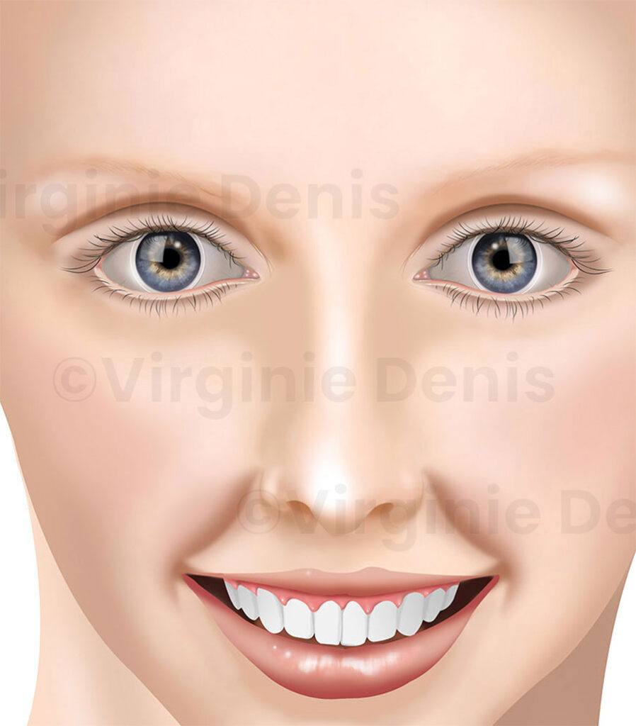 Illustration des yeux avec lentilles de contact