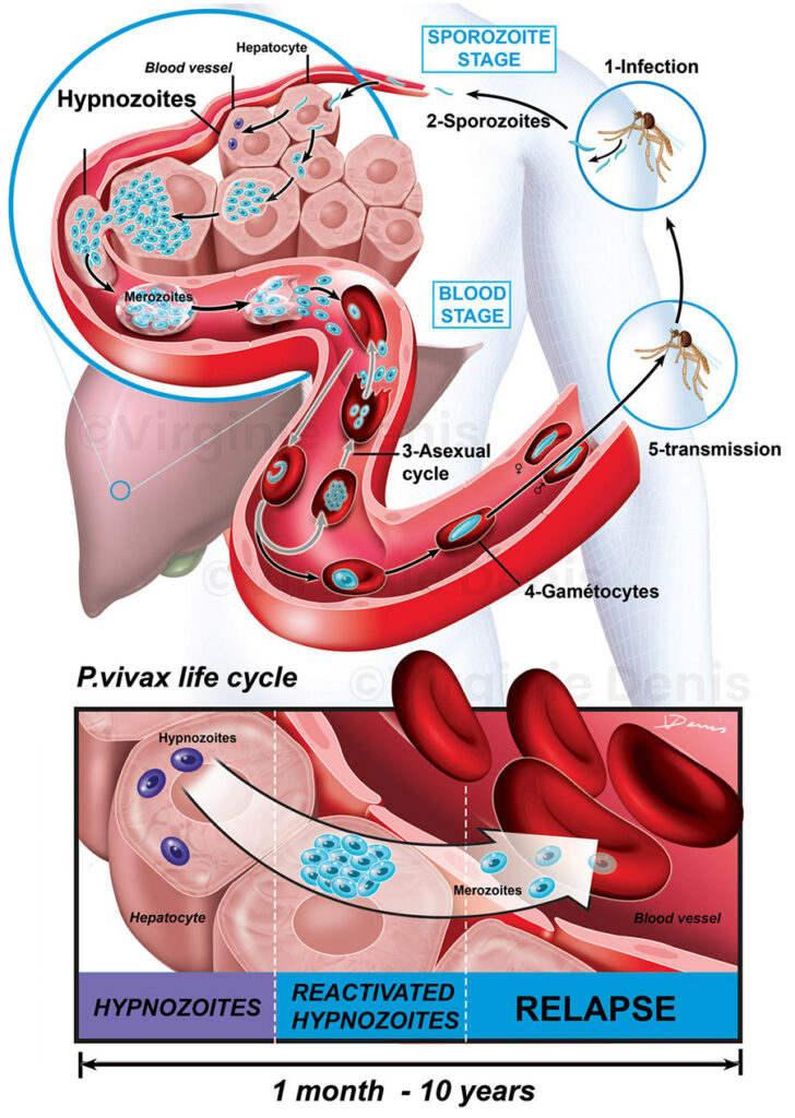 illustration médicale paludisme