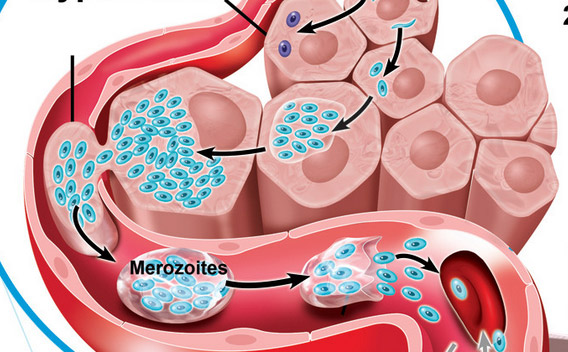 illustration médicale paludisme