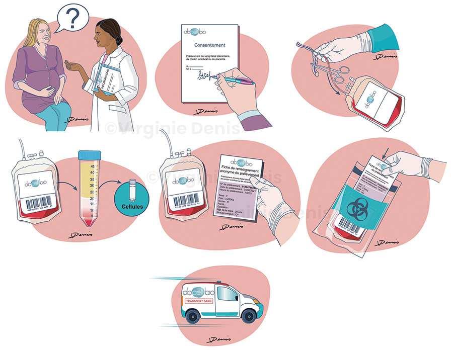 Illustration scientifique du parcours prélèvement du sang fœtal placentaire, de cordon ombilical ou de placenta
